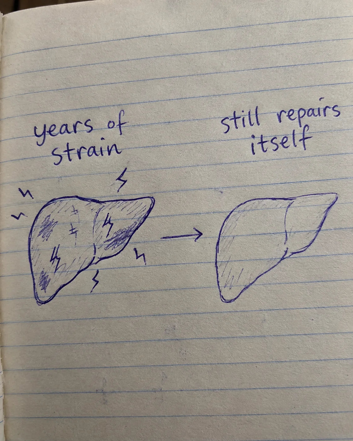 Handwritten notebook diagram of a liver: years of strain repairing itself over time