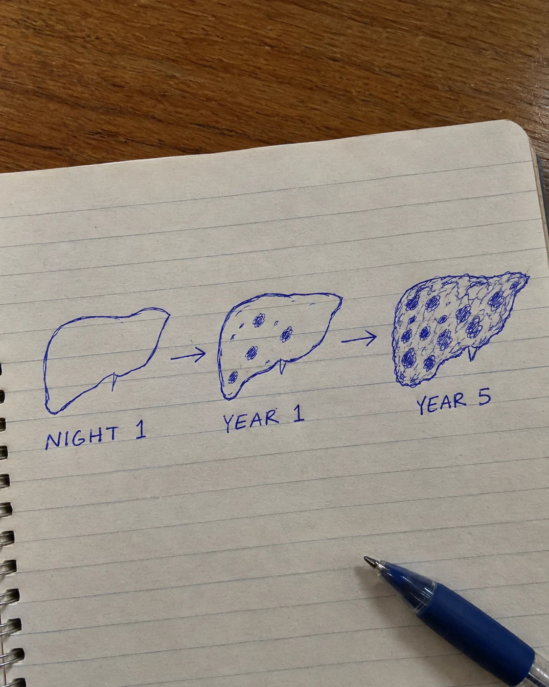 Hand-drawn journal diagram showing a liver's condition worsening from Night 1 to Year 1 to Year 5